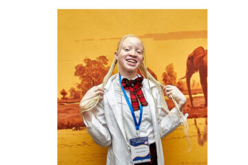 Zambian teen creates life-saving sunscreen for people with albinism