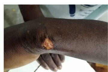 Military Police accused of brutally beating a boy in Rundu